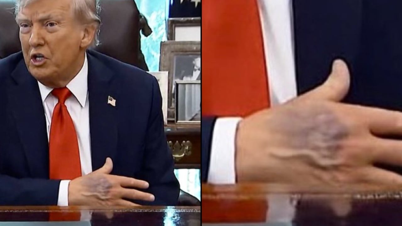 dora-e-nxire-e-trump-ben-xhiron-e-rrjetit,-shtepia-e-bardhe-sqaron-cfare-i-ka-ndodhur-presidentit-amerikan dora-e-nxire-e-trump-ben-xhiron-e-rrjetit,-shtepia-e-bardhe-sqaron-cfare-i-ka-ndodhur-presidentit-amerikan