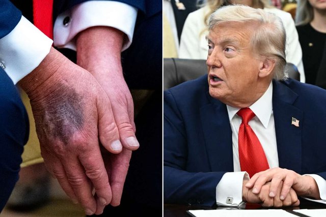 a-eshte-i-semure?-donald-trump-“thyen-heshtjen”-pas-thashethemeve-per-shendetin-e-tij:-ja-cfare-po-ndodh-me-doren-time a-eshte-i-semure?-donald-trump-“thyen-heshtjen”-pas-thashethemeve-per-shendetin-e-tij:-ja-cfare-po-ndodh-me-doren-time
